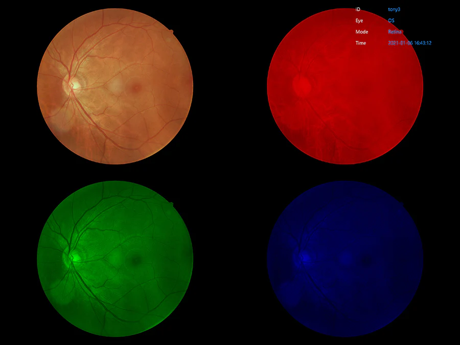 Ezer Cámara Retinal EFC-2600 — imagen de detalle 5 de 23