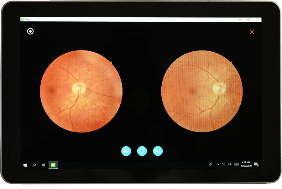 Ezer Cámara Retinal EFC-2600 — imagen de detalle 3 de 23