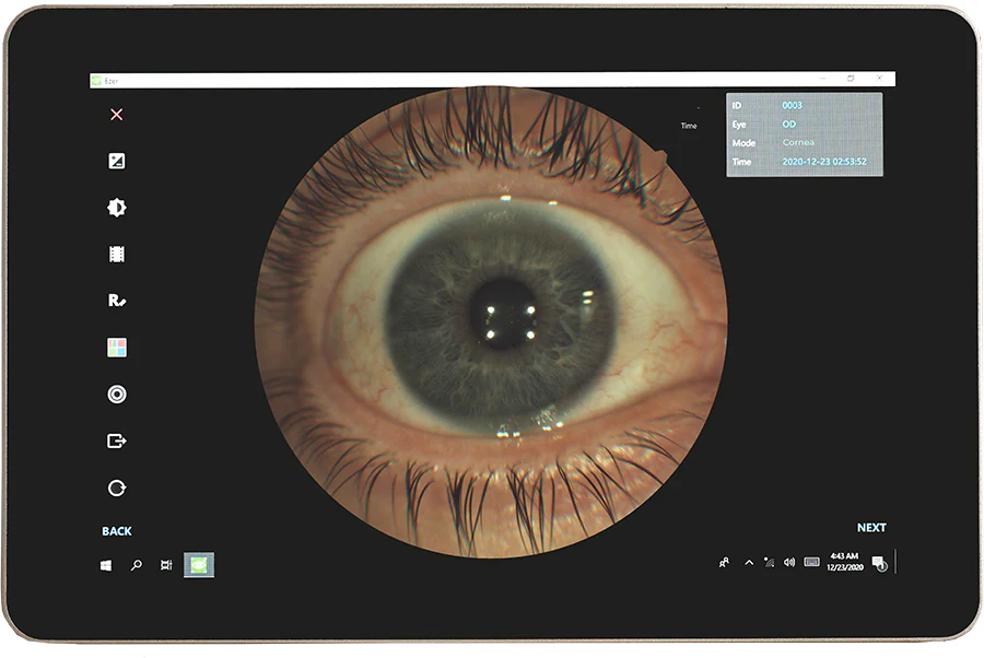 Ezer Cámara Retinal EFC-2600 — imagen de detalle 7 de 23
