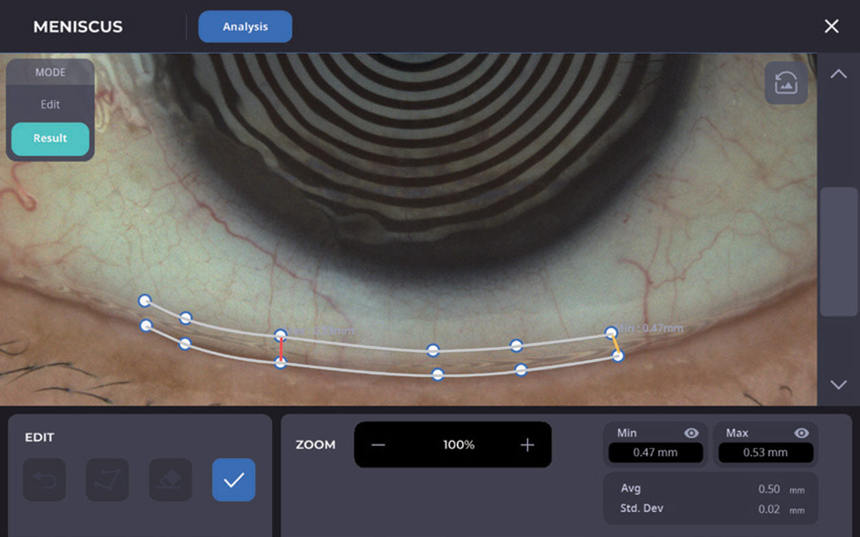 Huvitz Topógrafo Corneal HTG-1 D — imagen de detalle 1 de 14