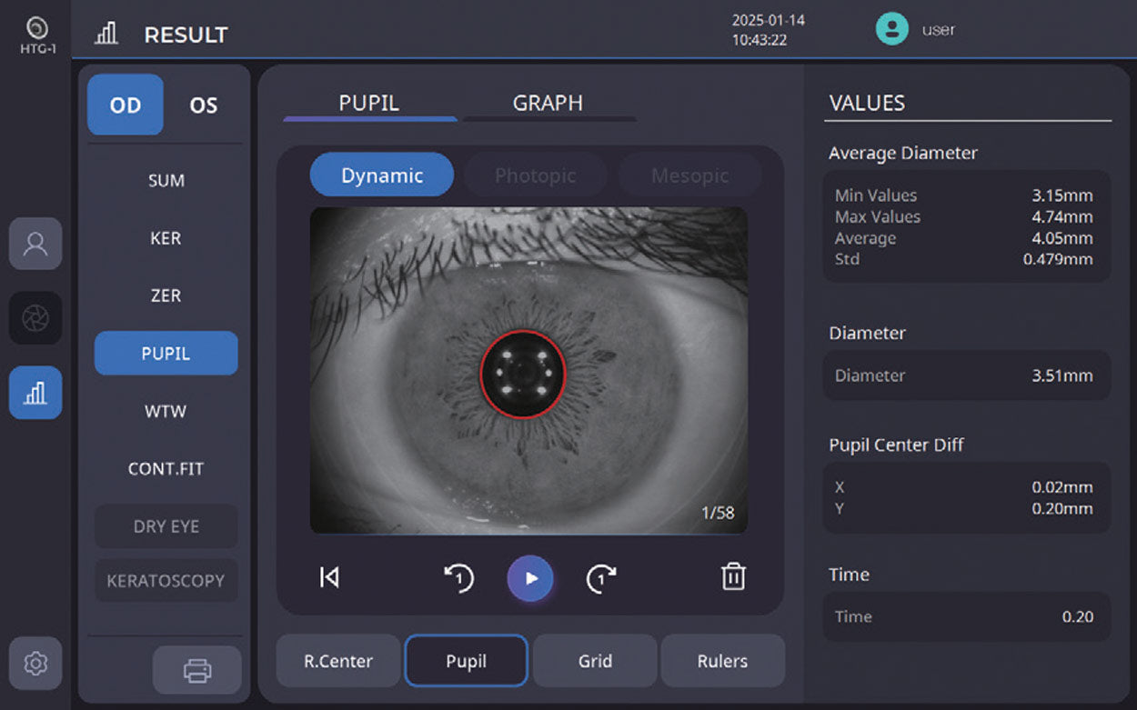 Huvitz Topógrafo Corneal HTG-1 D — imagen de detalle 11 de 14