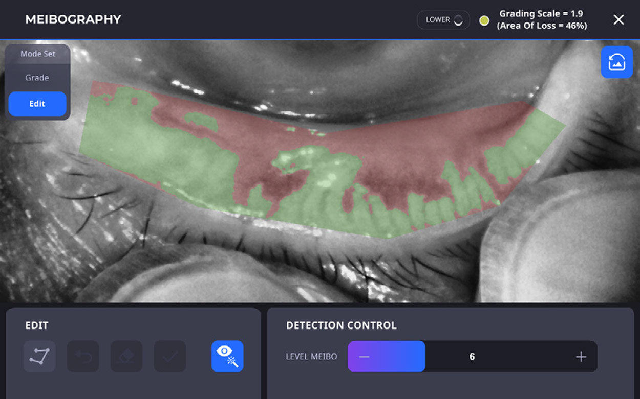 Huvitz Topógrafo Corneal HTG-1 D