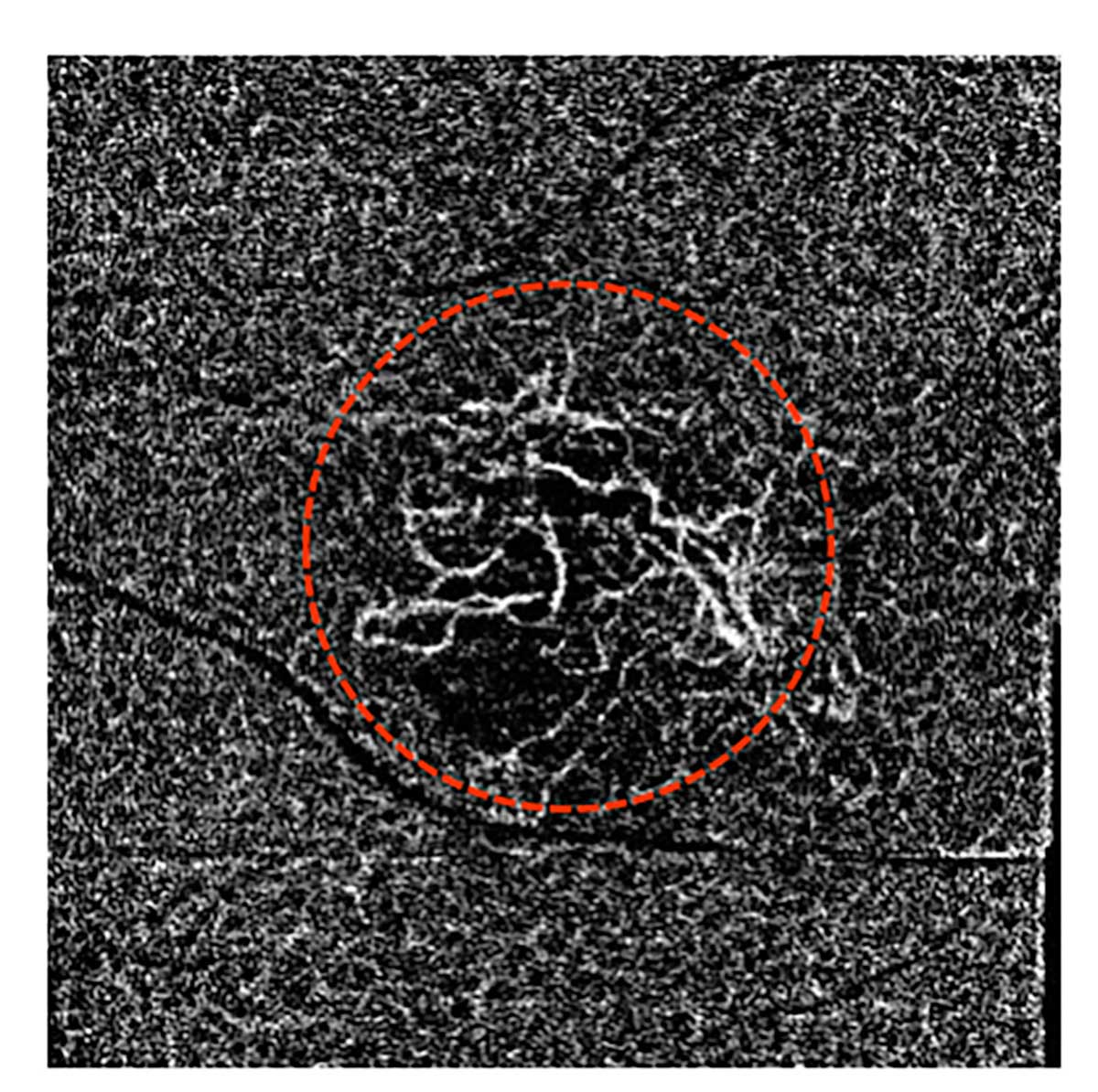Huvitz Tomógrafo de Coherencia Óptica HOCT-1(80) — imagen de detalle 5 de 19
