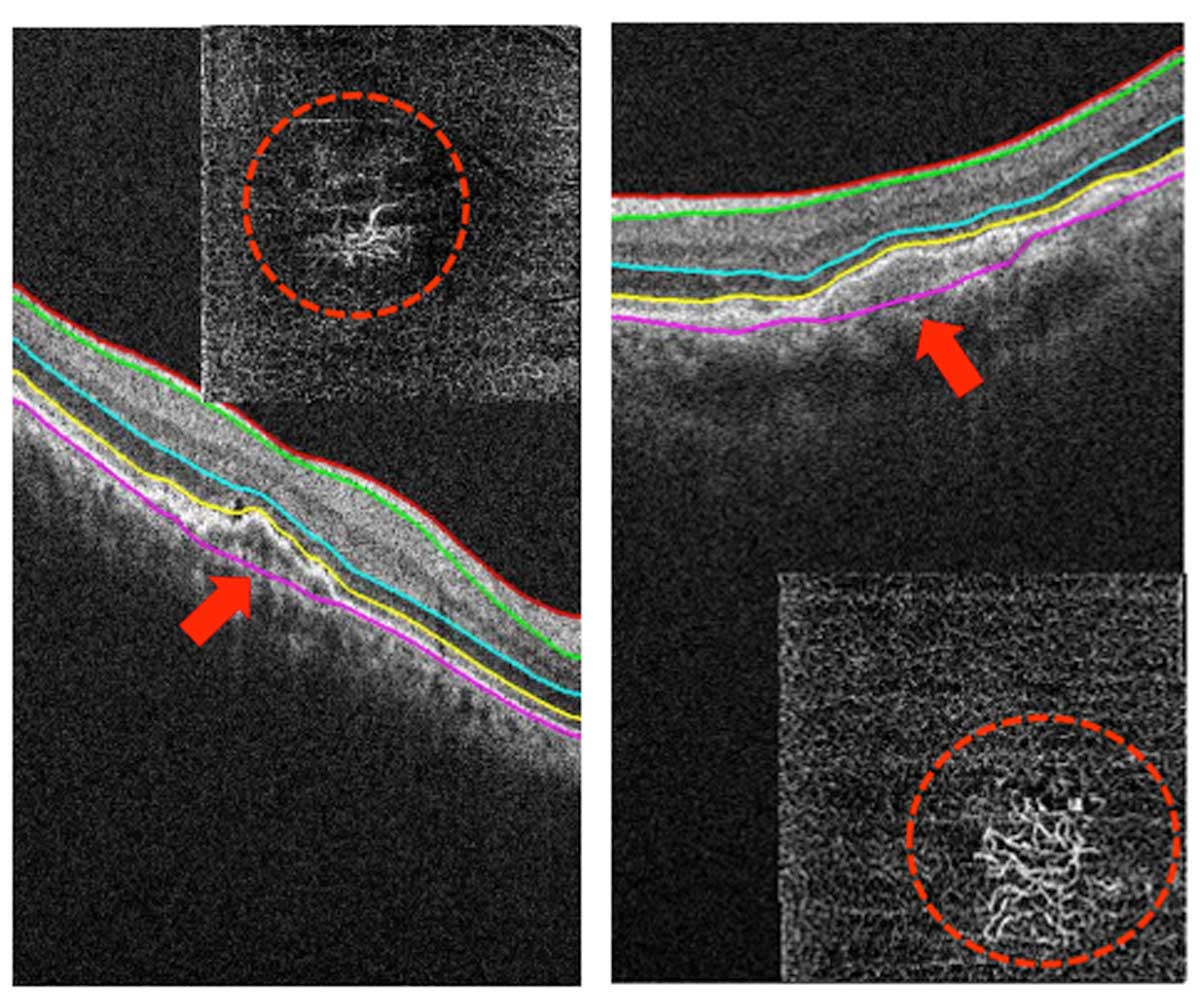 Huvitz Tomógrafo de Coherencia Óptica HOCT-1(80) — imagen de detalle 6 de 19