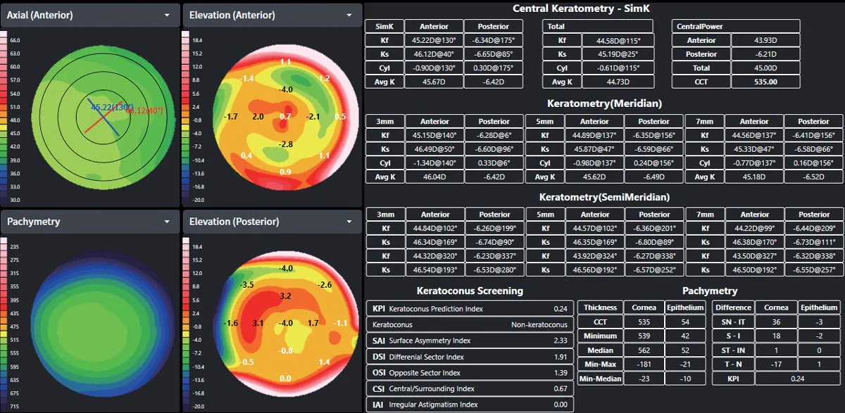 Huvitz Tomógrafo de Coherencia Óptica HOCT-1(80) — imagen de detalle 7 de 19