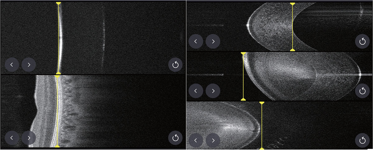 Huvitz Tomógrafo de Coherencia Óptica HOCT-1(80) — imagen de detalle 9 de 19