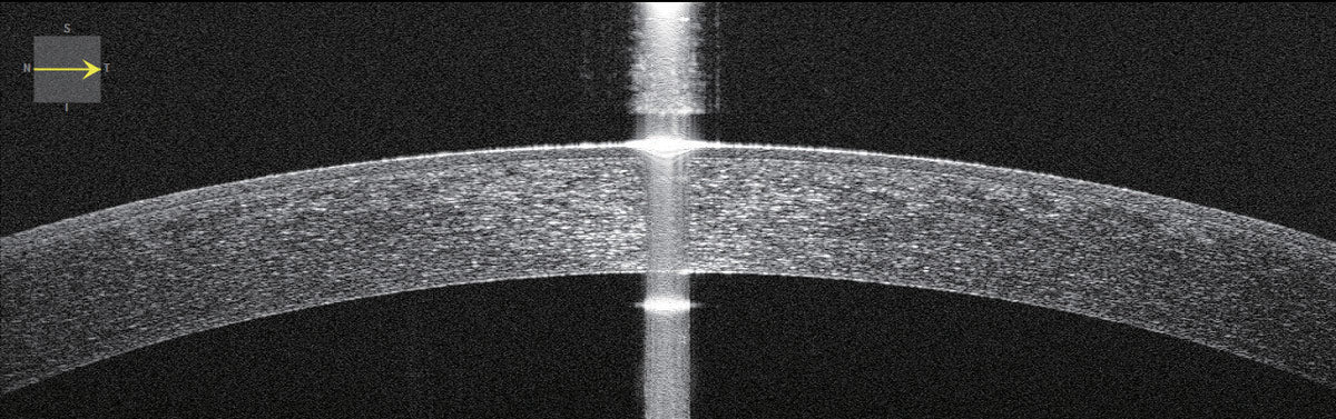 Huvitz Tomógrafo de Coherencia Óptica HOCT-1(80) — imagen de detalle 13 de 19
