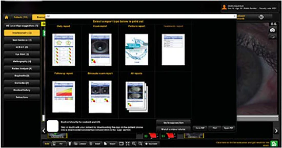 Ezer Topógrafo Corneal Onyx Full — imagen de detalle 28 de 35