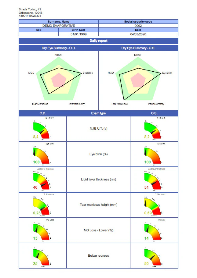 Ezer Topógrafo Corneal Onyx Full — imagen de detalle 29 de 35
