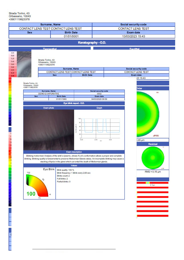 Ezer Topógrafo Corneal Onyx Full — imagen de detalle 31 de 35