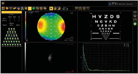 Ezer Topógrafo Corneal Onyx Full — imagen de detalle 9 de 35