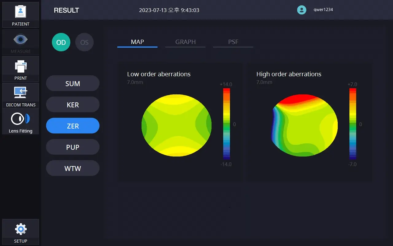 Huvitz Topógrafo Corneal HTG-1 — imagen de detalle 3 de 9