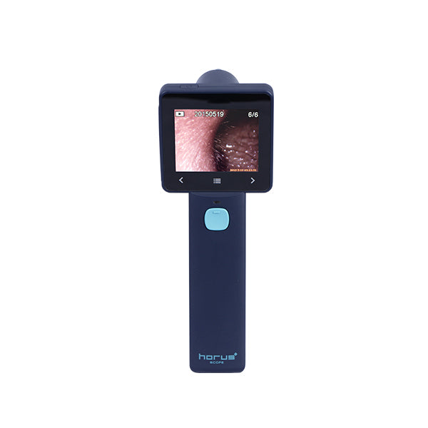 Miis EZ-Horus OTO Blue Otoscopio Digital