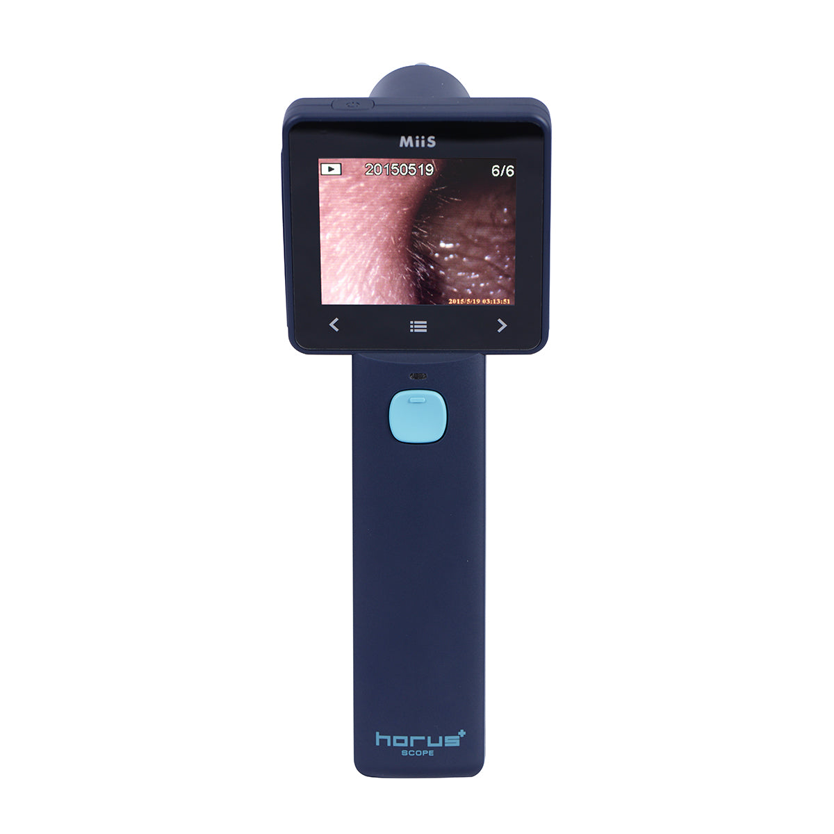 Miis EZ-Horus OTO Blue Otoscopio Digital