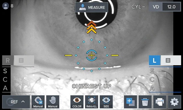Luxvision Autorrefractómetro / Queratómetro LRK-7800 — imagen de detalle 5 de 14
