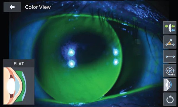 Luxvision Autorrefractómetro / Queratómetro LRK-7800 — imagen de detalle 3 de 14