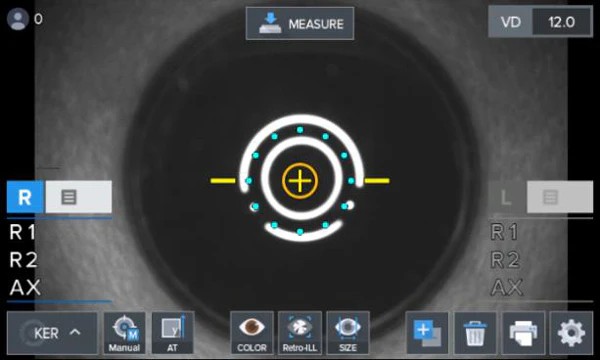 Luxvision Autorrefractómetro / Queratómetro LRK-7800 — imagen de detalle 4 de 14