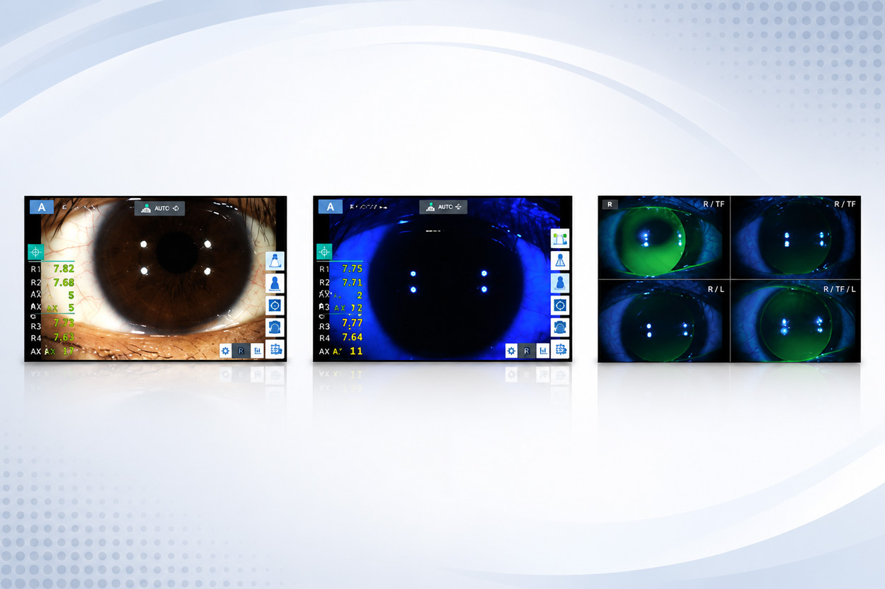Luxvision Autorrefractómetro / Queratómetro LRK-7800 — imagen de detalle 13 de 14