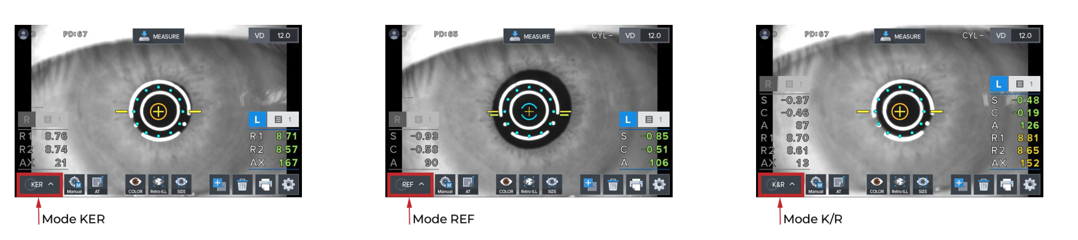 Luxvision Autorrefractómetro / Queratómetro LRK-7800 — imagen de detalle 12 de 14