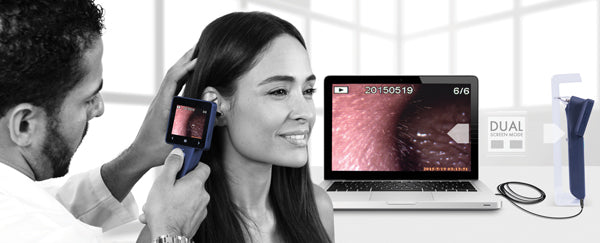 Ezer Otoscopio Digital EZ-Horus OTO Blue de MiiS — imagen de detalle 1 de 4