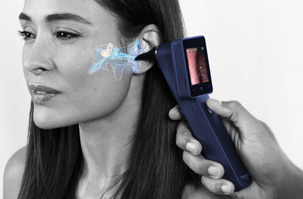 Ezer Otoscopio Digital EZ-Horus OTO Blue de MiiS — imagen de detalle 2 de 4