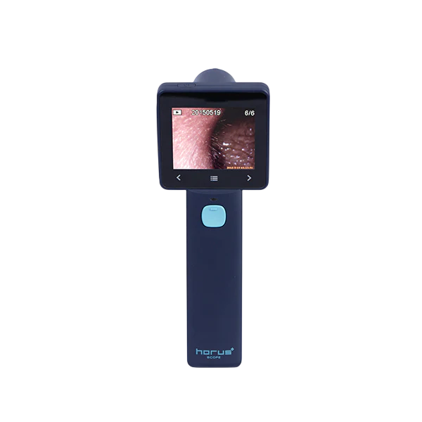 Ezer Otoscopio Digital EZ-Horus OTO Blue
