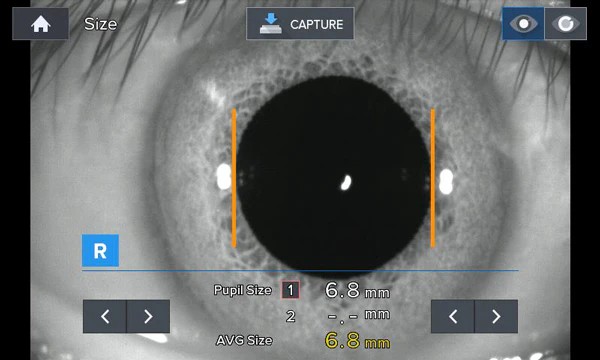 Luxvision Autorrefractómetro / Queratómetro LRK-7800 — imagen de detalle 2 de 14