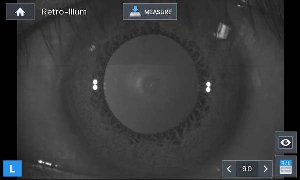 Luxvision Autorrefractómetro / Queratómetro LRK-7800 — imagen de detalle 1 de 14