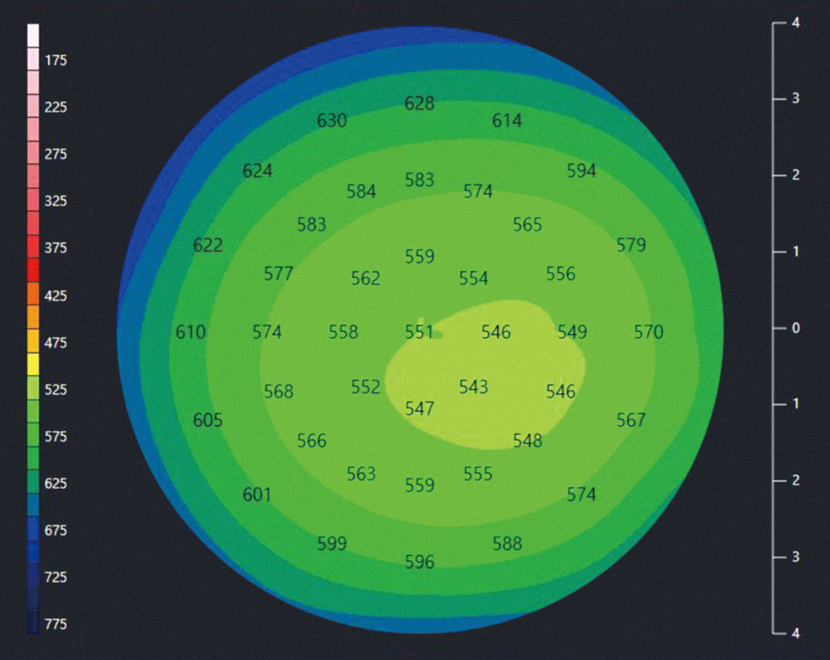 Huvitz Módulo de Topografía HOCT-Topography Module — imagen de detalle 8 de 10