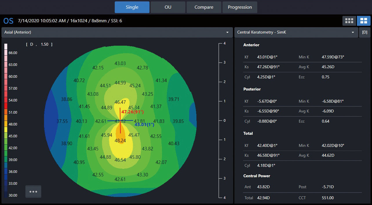 Huvitz Módulo de Topografía HOCT-Topography Module — imagen de detalle 5 de 10