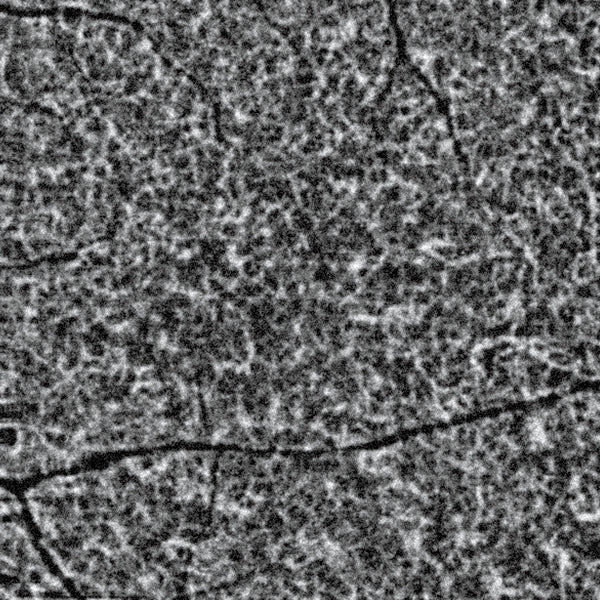 Huvitz Módulo de Angiografía H Angio Module — imagen de detalle 4 de 13