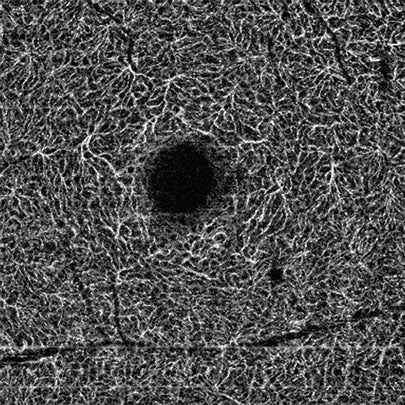 Huvitz Módulo de Angiografía H Angio Module — imagen de detalle 12 de 13