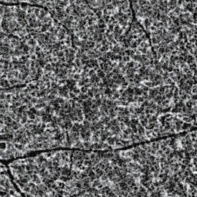 Huvitz Módulo de Angiografía H Angio Module — imagen de detalle 10 de 13
