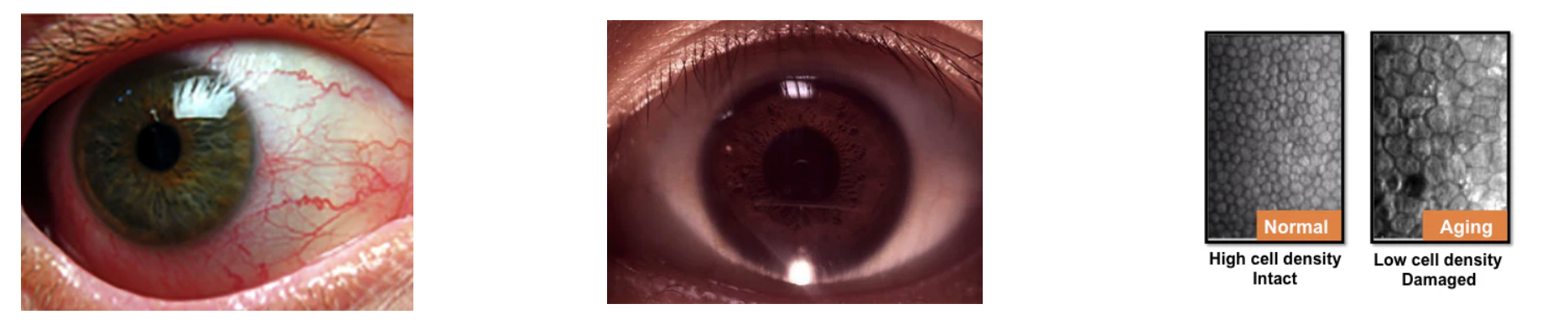 Ezer Lente de Segmento Anterior EZ-Horus Anterior Lens AF — imagen de detalle 1 de 3