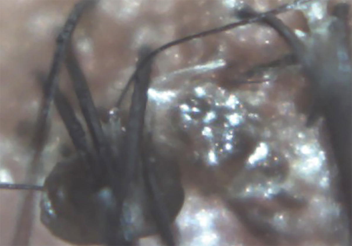 Ezer Ojo Seco Sapphire — imagen de detalle 11 de 28
