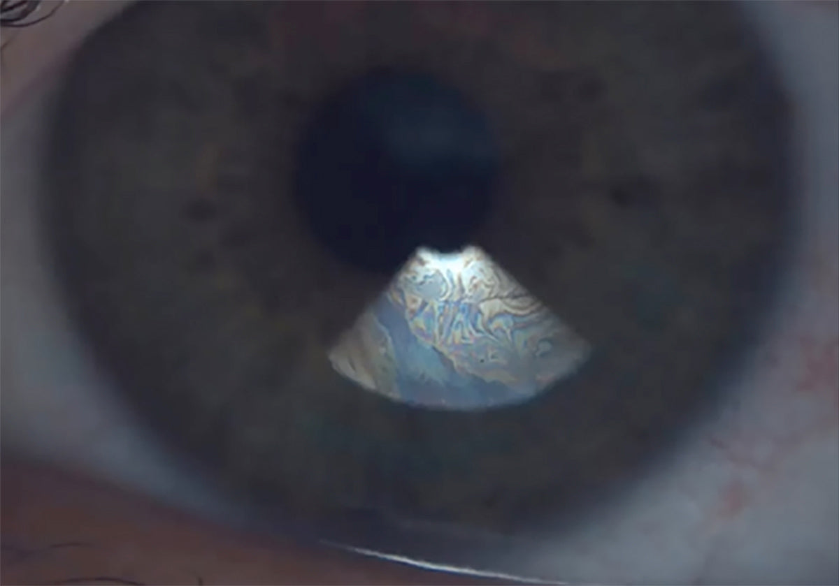 Ezer Ojo Seco Sapphire A+ — imagen de detalle 4 de 38