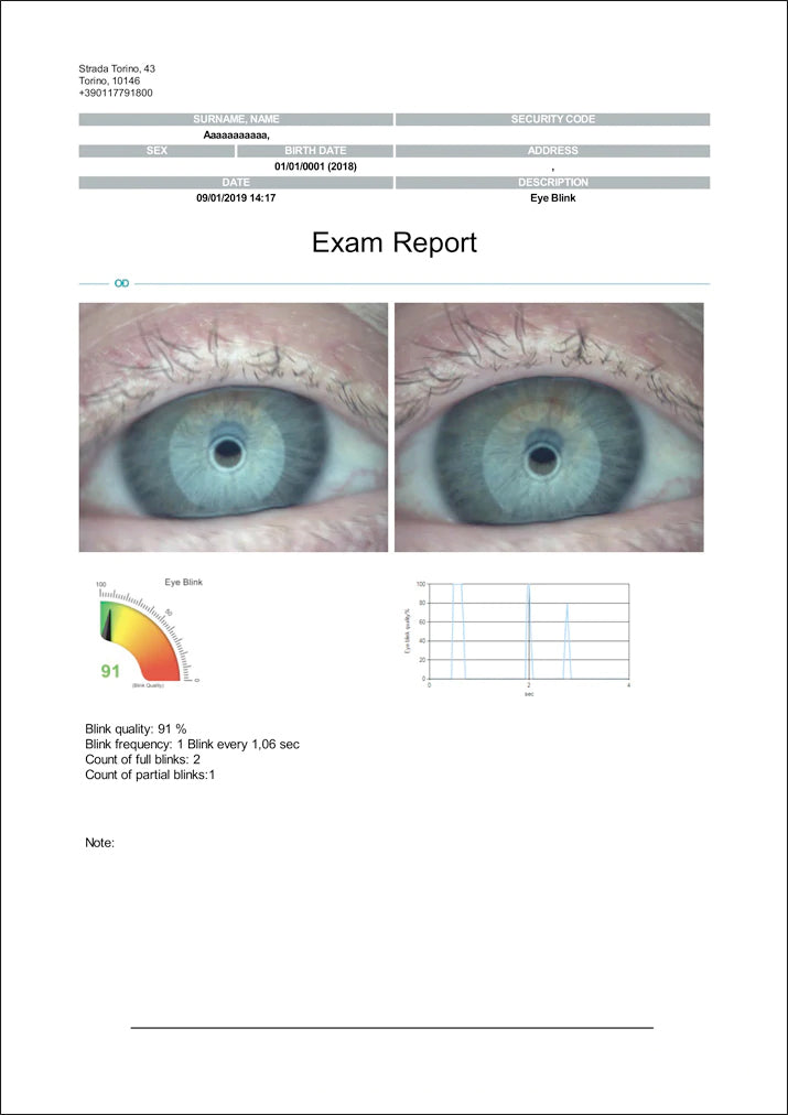 Ezer Ojo Seco Sapphire A+ — imagen de detalle 34 de 38