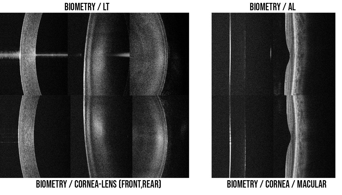Huvitz Módulo de Biometría HOCT-Biometry Module — imagen de detalle 1 de 4