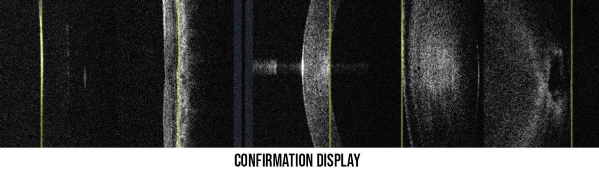 Huvitz Módulo de Biometría HOCT-Biometry Module — imagen de detalle 2 de 4