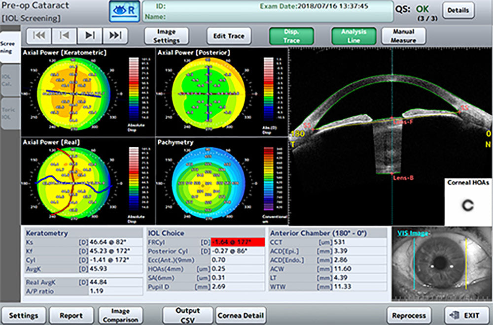 Tomey Tomografía de Coherencia Óptica (OCT) Corneal y de Segmento Anterior CASIA2