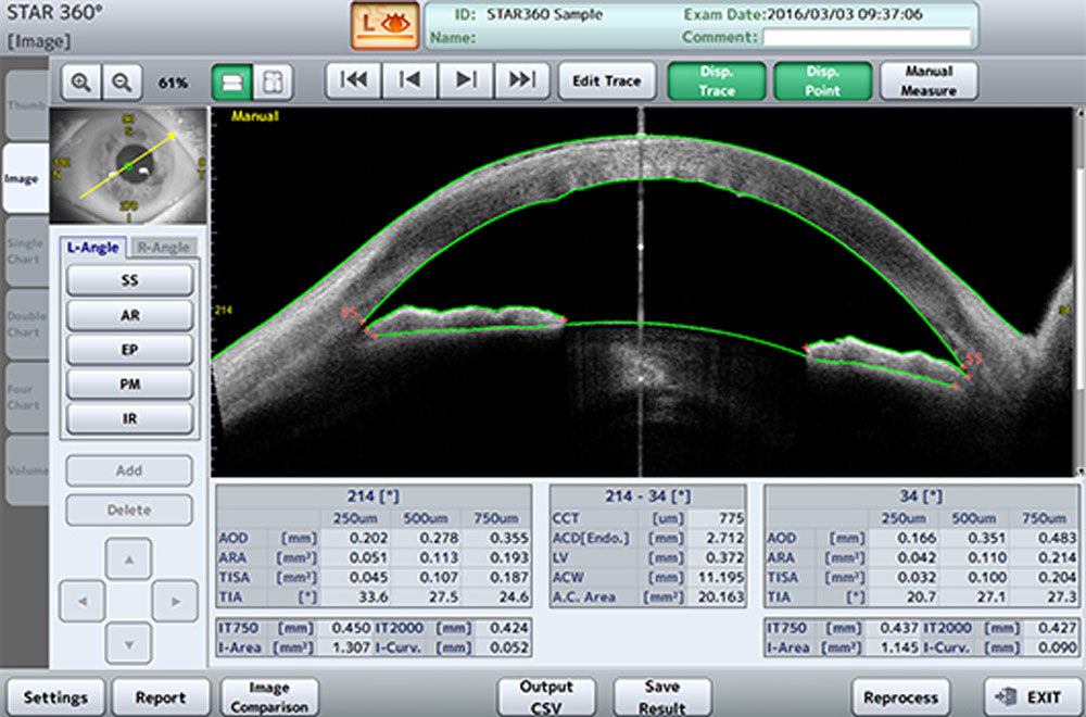 Tomey Tomografía de Coherencia Óptica (OCT) Corneal y de Segmento Anterior CASIA2 — imagen de detalle 4 de 9