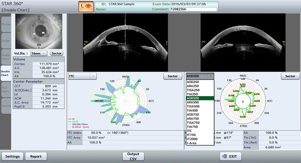Tomey Tomografía de Coherencia Óptica (OCT) Corneal y de Segmento Anterior CASIA2 — imagen de detalle 5 de 9