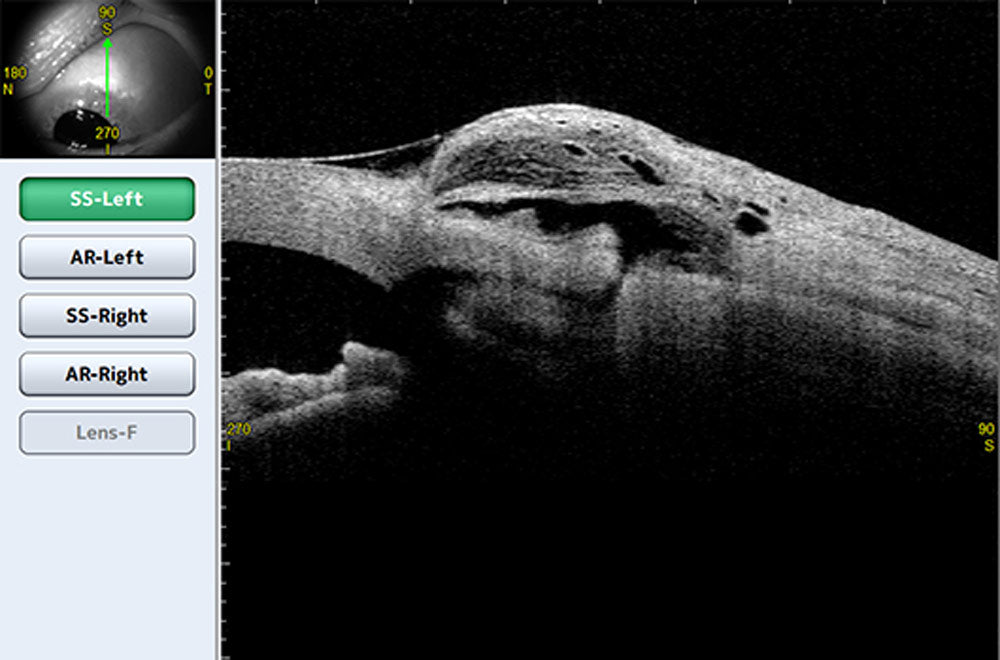Tomey Tomografía de Coherencia Óptica (OCT) Corneal y de Segmento Anterior CASIA2 — imagen de detalle 6 de 9