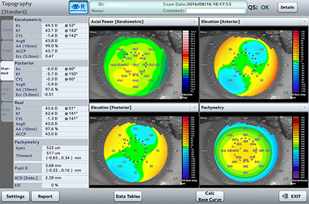 Tomey Tomografía de Coherencia Óptica (OCT) Corneal y de Segmento Anterior CASIA2 — imagen de detalle 7 de 9