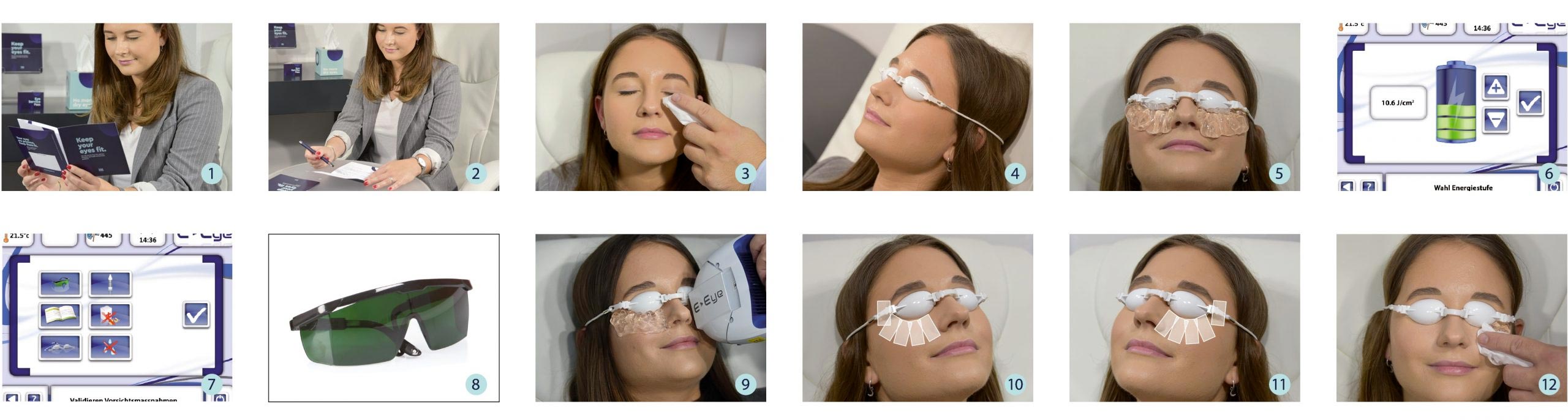 E-SWIN Tratamiento IRPL E-EYE IRPL — imagen de detalle 4 de 11