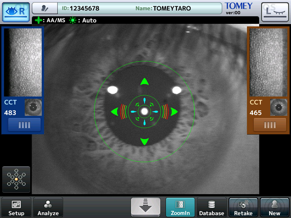 Tomey Microscopio Especular EM-4000 — imagen de detalle 1 de 9