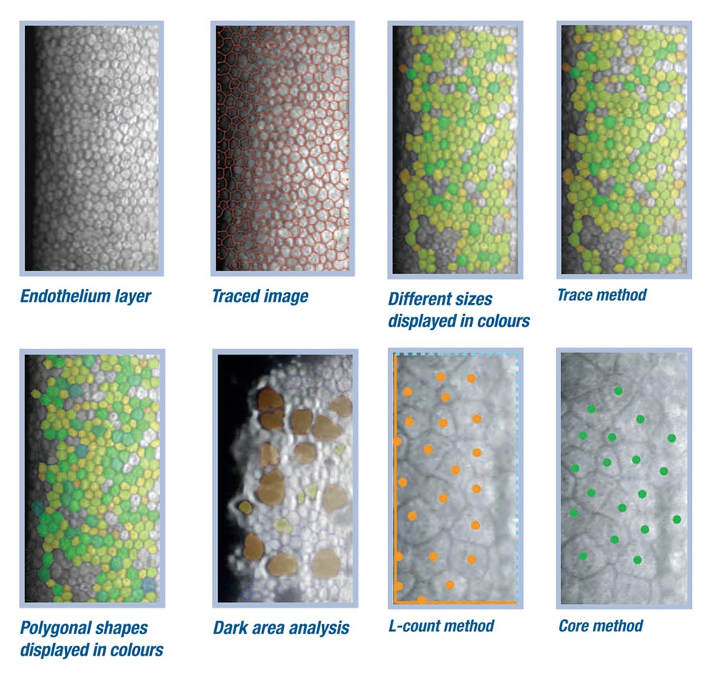 Tomey Microscopio Especular EM-4000 — imagen de detalle 5 de 9