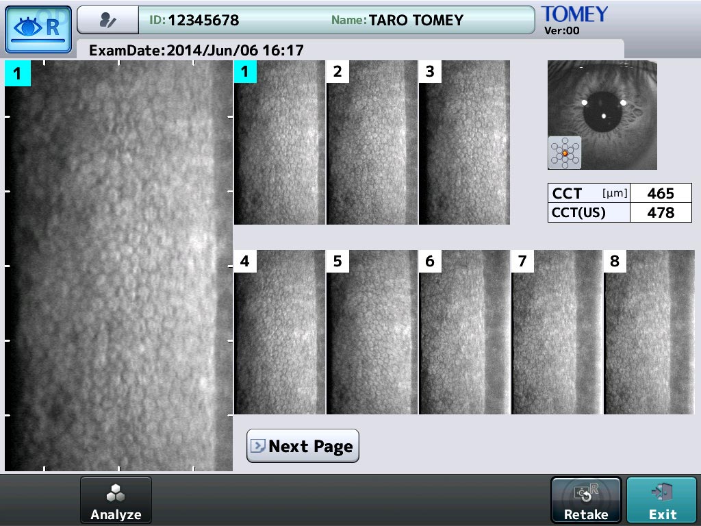 Tomey Microscopio Especular EM-4000 — imagen de detalle 4 de 9