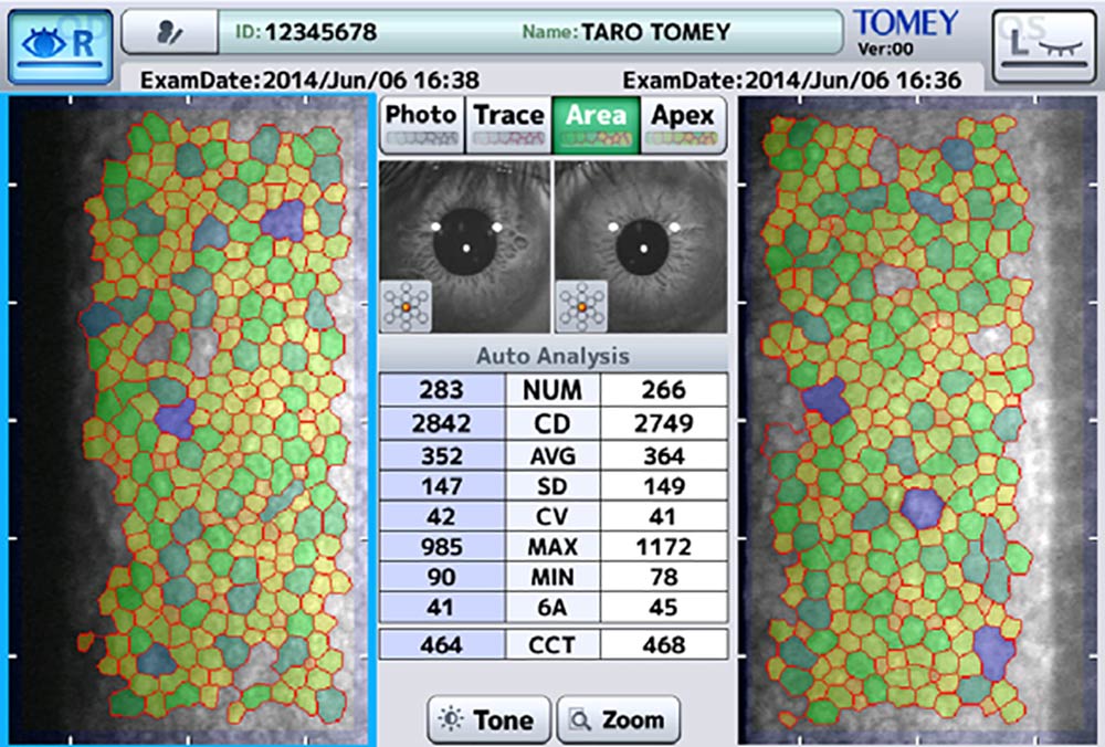 Tomey Microscopio Especular EM-4000 — imagen de detalle 7 de 9