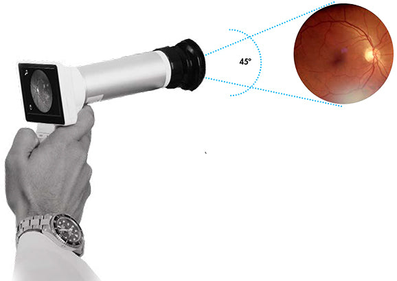 Ezer Lente Horus (Compatible con Cámara de Enfoque Automático EZ-Horus) EZ-Horus Lens 45 — imagen de detalle 1 de 4